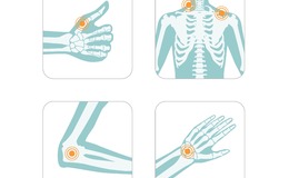 Prolonged manual pipetting puts users at risk of developing hand, neck and shoulder injuries