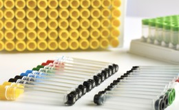 Food safety is an issue of significant and growing importance