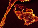 Macrophages
