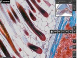 The OlyVIA Mobile iPad App is designed for images captured with the Olympus VS120 virtual slide scan