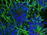 AMSBIO offers an extensive range of iPSC derived neural cells