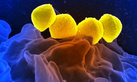 Group A Streptococcus Bacteria on Human Neutrophil