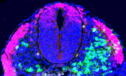 Lab grows spinal cord 'seed' for first time