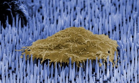 Colourised cell on nanoneedles