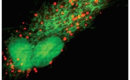 Live cell imaging of cell nucleus CellLight reagents.jpg