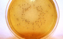 Lab M listeria media range