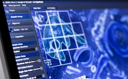 Atlas 5 extends the capacity of ZEISS scanning electron microscopes