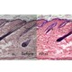 Before and After Chromacal
